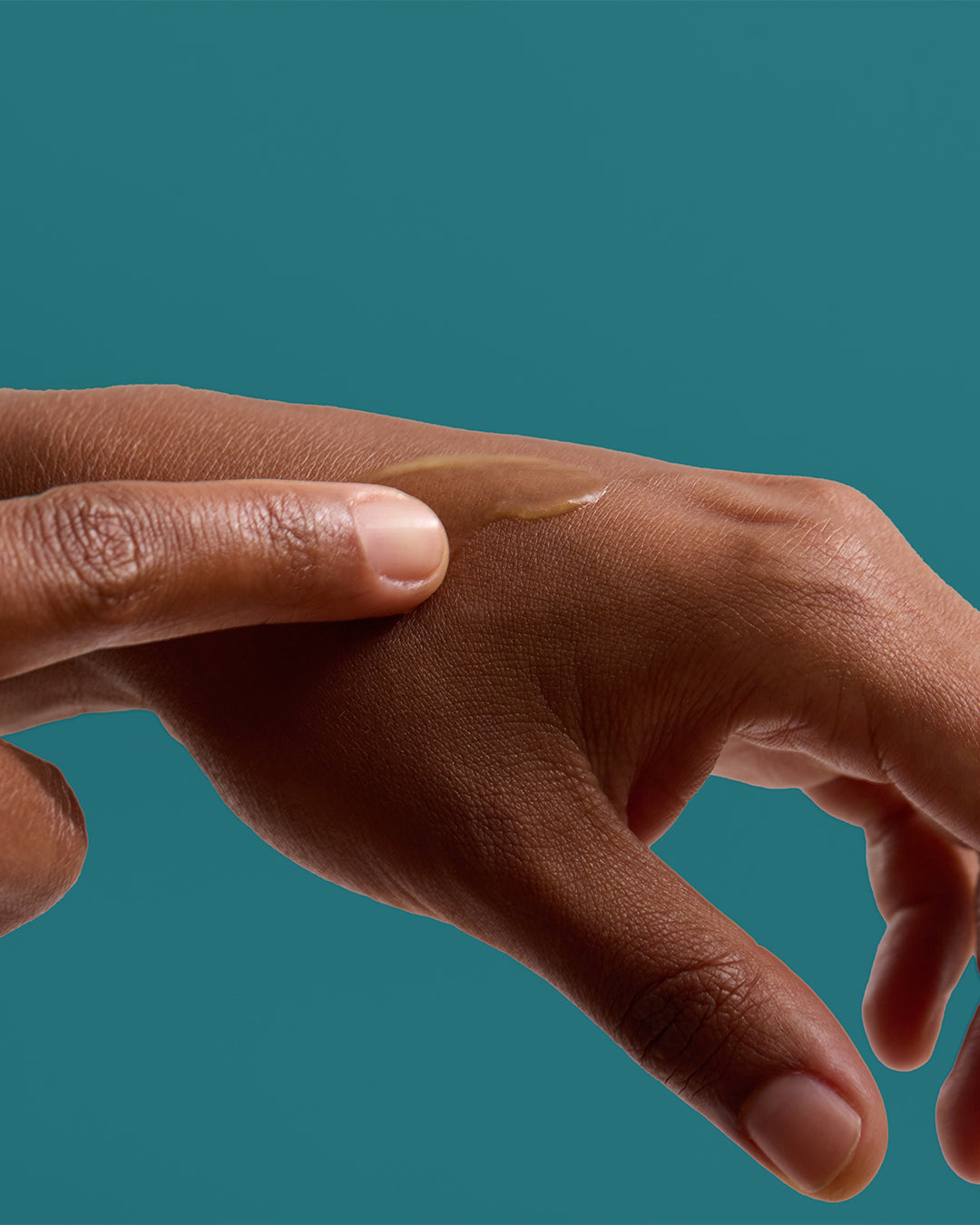 SOS Pechsalbe - Lärchenharz