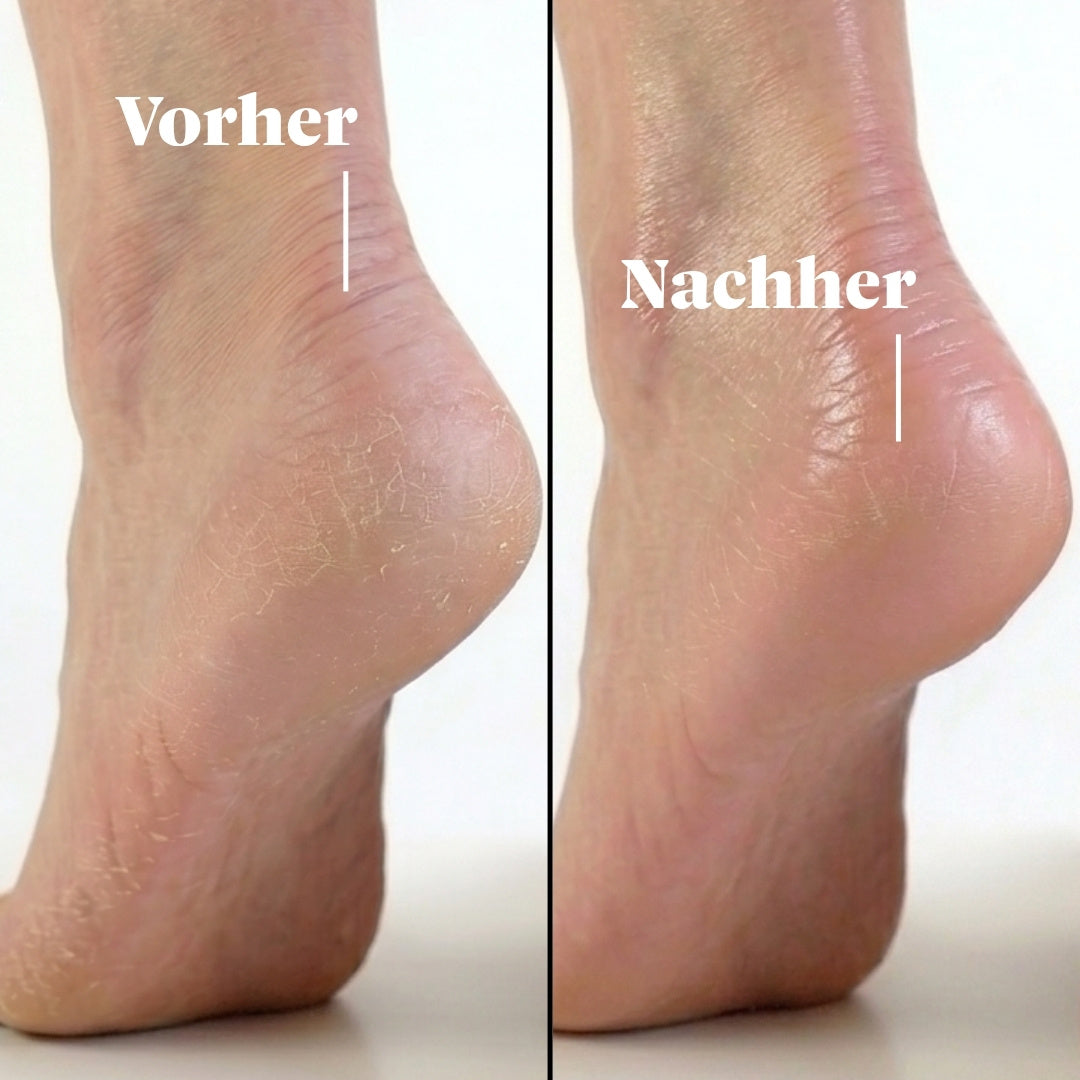 Aus rau wird streichelzart